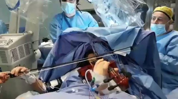 Taranto - SS. Annunziata: ragazza di 23 anni operata al cervello mentre suona il violino. | VIDEO