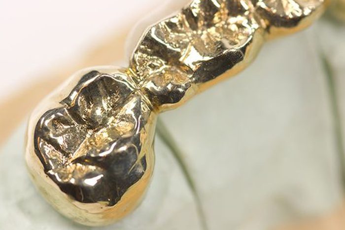 La storia dei denti d'oro rubati al nonno