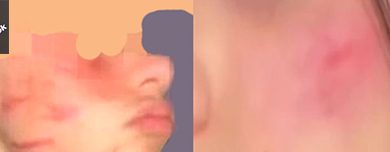 Follia tra i giovani, la cicatrice francese