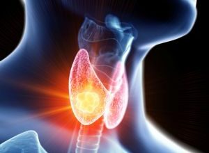 Echolaser rimozione tumore tiroide Bari