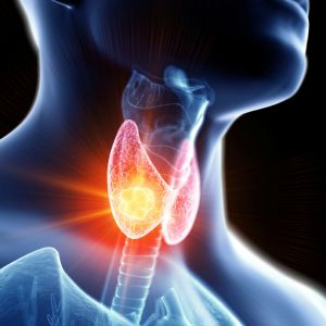 Echolaser rimozione tumore tiroide Bari