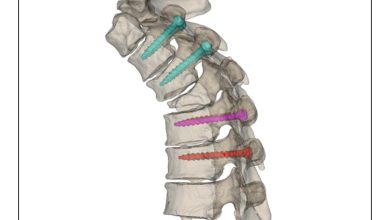 Mascherine vertebrali 3D