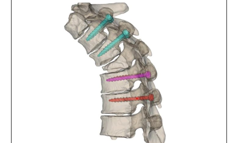 Mascherine vertebrali 3D
