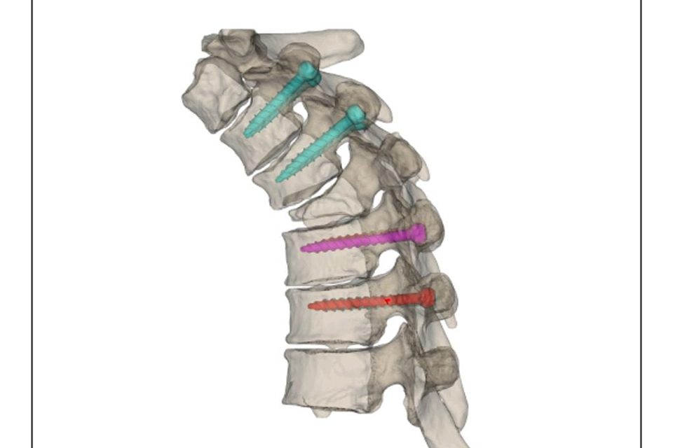 Mascherine vertebrali 3D