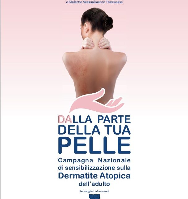 Open Day Dermatite Atopica in Puglia