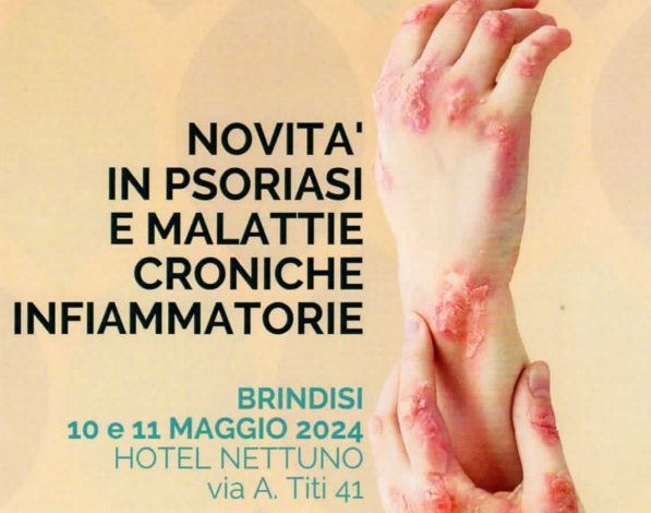 Psoriasi e nuove terapie