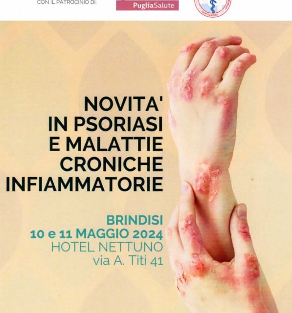 Psoriasi e nuove terapie