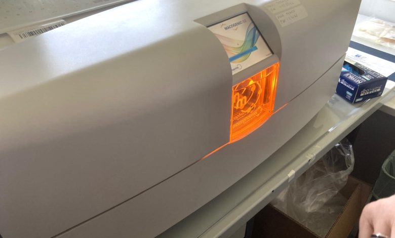 nuova terapia antirigetto