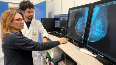 tecnologia di intelligenza artificiale nella prevenzione senologica presso ASL Bari